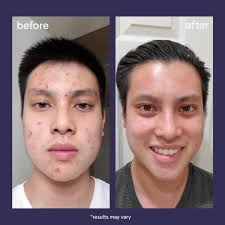 Men Skin Care Products Mens Skin Care Men Skin Care Routine Skincare Quotes
