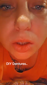 Jessedent Bottom Dentures