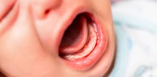 Sowohl die milchzähne als auch die bleibenden zähne sind schon vor der geburt des kindes im kiefer angelegt. Stiftung Kindergesundheit Zahnekriegen Macht Nicht Krank Zwp Online Das Nachrichtenportal Fur Die Dentalbranche