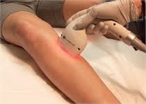 We've tested, and used many types of lasers in our office. Laser Hair Removal Dallas Tx Christine Brown M D