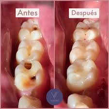 VÍKOMO Dentista en Tampico - Madero