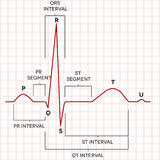 sinus rhythm stock illustrations 188 sinus rhythm stock