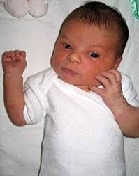 Herpes simplex virus, more commonly known as herpes affects 1 in 6 people. How A Simple Cold Sore Cost Me My Baby Daily Mail Online