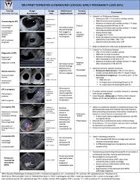 Image result for First Trimester Ultrasound
