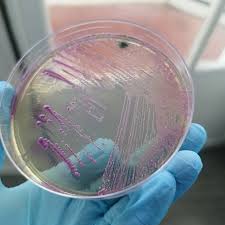 Image result for Staphylococcus Saprophyticus