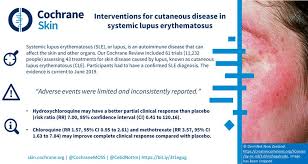 It is also referred to as discoid lupus erythematosus. Pdf Interventions For Cutaneous Disease In Systemic Lupus Erythematosus