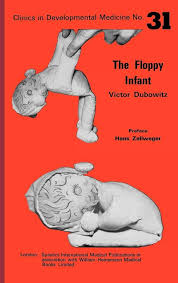 Image result for Floppy Infant
