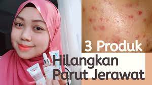 Sifat inilah yang mampu menghilangkan jerawat secara ampuh di. 3 Produk Untuk Hilangkan Parut Jerawat Menjadi Youtube