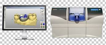Cad Cam Dentistry Crown Dental Restoration Inlays And Onlays Png Clipart Bridge Cadcam Dentistry Communication Computer
