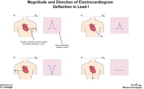 Electrocardiogram Ecg Cardiovascular Medbullets Step 1