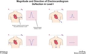 electrocardiogram ecg cardiovascular medbullets step 1