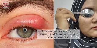 Syarat dan kebijakan terbaru ini akan diterapkan pada pembaharuan terkini aplikasi whatsapp dengan nomor seri. Konon Suka Intai Orang Mandi Pakar Bongkar Punca Sebenar Masalah Ketumbit Kisah Dunia
