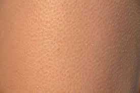 A page for describing fridge: Have You Ever Had A Skin Orgasm Psychology Today