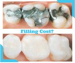 We did not find results for: How Much Does It Cost To Extract A Tooth Arxiusarquitectura
