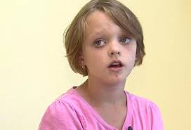 Novel procedure slows abnormal growth in young girl's leg