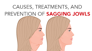 In terms of skincare alone, my videos have. Causes Treatments Prevention Of Sagging Jowls Womenworking