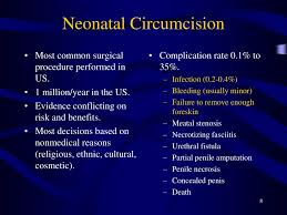 Image result for Neonatal Circumcision