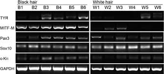 They have thick hair and beautiful long locks. Downregulation Of C Kit Mitf M In Graying Hair Of Juvenile Poliosis Html Acta Dermato Venereologica