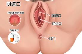 外阴口图片_39健康网