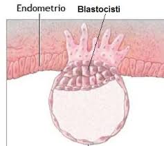 Si tratta tuttavia di una sensazione soggettiva, perché il corpo estraneo che si avverte in gola in realtà non esiste e non sono presenti altri sintomi. Perdite Da Impianto Aspirante Mamma