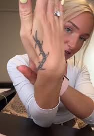 2025 Bride Removing Tattoo