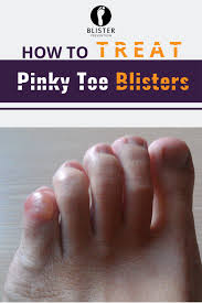 Pin On Hiking Hacks