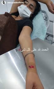 وأعلنت نانسي صلاح خبر انفصالها عن سامح عبد العزيز، قبل ساعات قليلة، عبر حسابها العمل سويًا، عام 2016، في إحدى حلقات برنامج snl بالعربي، والتي ظهرت فيها نانسي صلاح. Ù…Ø¹Ù„ÙˆÙ…Ø§Øª Ø¹Ù† Ø§Ù„ÙÙ†Ø§Ù†Ø© Ù†Ø§Ù†Ø³Ù‰ ØµÙ„Ø§Ø­ Ø§Ù„Ù…ØµØ§Ø¨Ø© ÙÙ‰ ØªÙØ¬ÙŠØ±Ø§Øª Ø¨ÙŠØ±ÙˆØª Ø¨ÙˆØ§Ø¨Ø© ÙÙŠØªÙˆ