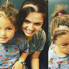 Mom Shaves Head To Match Daughter's Brain Surgery Scar