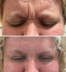 Lash Perms are IN ✨ Book your lash perm appointment using the link in our  bio! #elevatemedaesthetics #ohiomedspa #medspa #aesthetician