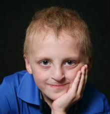 Hair Symptoms National Foundation For Ectodermal Dysplasias