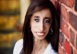 In january 2014 she gave a tedxaustinwomen talk titled how do you define yourself and her youtube videos have received over 54 million views. World S Ugliest Woman Now On Big Screen Hollywood News India Tv