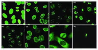Image result for ANA Staining Pattern