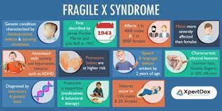 Fragile X Syndrome