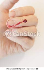 Won't make it any better. Closeup Of Finger Human Hand Is Cut Hurt Bleeding With Bright Red Blood Bleeding Blood From The Cut Finger Wound Injured Canstock