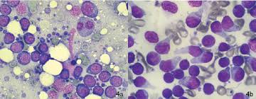The best diet for the canine having lymphoma is a dog food having high quality of proteins with lowest carbohydrates because it is the matter of blood cells and proteins can give the more life to your dog and increase the. Microscopic Pictures Showing The Typical Cytological Appearance Of A Download Scientific Diagram