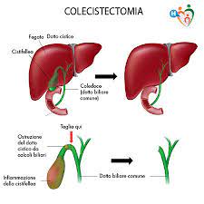 Pane integrale, pane tostato, fette biscottate; Calcoli Alla Cistifellea Cause Dieta E Rimedi