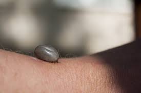 Apuca si trage usor, pana cand se despinde de piele. MuÈ™cÄƒtura De CÄƒpuÈ™Äƒ Ce Faci DacÄƒ Cel Mic A Devenit Victima Ei Totul Despre Mame