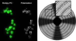 Image result for Polarized Microscopy