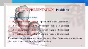 Image result for Brow Presentation