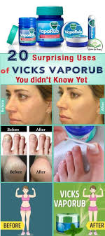 20 Surprising Uses Of Vicks Vaporub You Didn T Know Yet Vicks Vaporub Uses Vicks Vaporub Vicks Vapor Rub