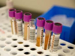 Rapid tests are considered most accurate in a patient who is current recommendation is to have a confirmation test performed (the pcr test) if you still have. Rapid Antigen Tests Can Be No More Than Adjunct To Rt Pcr Scientists Business Standard News