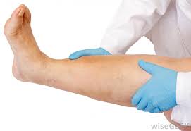 As kidney failure progresses, patients can feel renal disease is typically identified with lab and urine analysis. What Is Renal Parenchymal Disease With Pictures