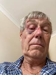 Barney beat downham by 68 runs. Batting first Barney set 299 off there 40  overs. Alec Payne top scoring with 80. Other notable contributions from  Oscar Campbell 66* and phoenix Sherry 49.