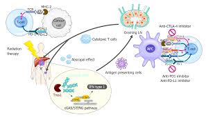 Enter & enjoy it now! Optimizing Radiotherapy With Immune Checkpoint Blockade In Hepatocellular Carcinoma