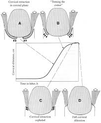 Image result for Active Management of Labor
