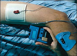 Image result for LET Anesthesia