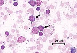 kopeklerde ehrlichiosis erlisya