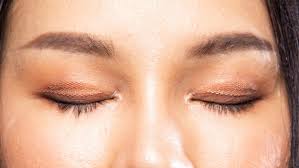 Eyelid surgery typically will last for many years and may also depend on how well you treat and maintain your skin. What Happens When You Wear Eyelid Tape Every Day