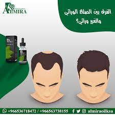 الفرق بين تساقط الشعر الوراثي و غير الوراثي movie posters movies poster