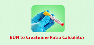 Maybe you would like to learn more about one of these? Lab Tests Infobun Creatinine Ratio Understand High Vs Low Levels Normal Range